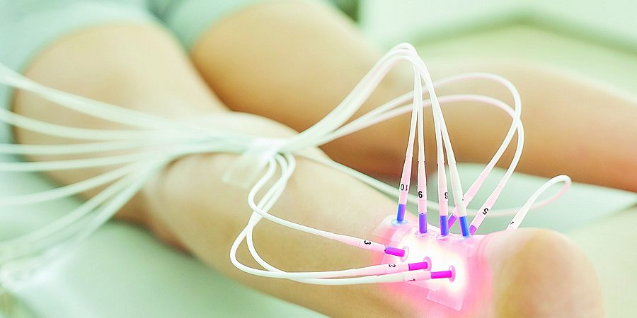 HITOP BEI POLYNEUROPATHIE HITOP BEI POLYNEUROPATHIE