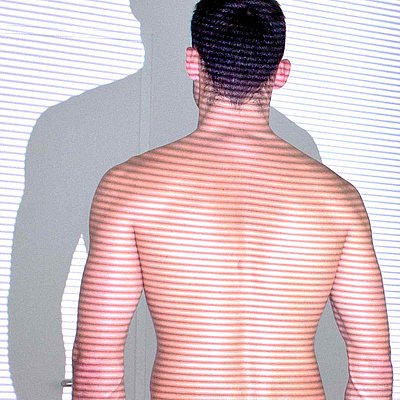 3D Haltungsanalyse mit Lichtoptischer Vermessung bei einem Mann.